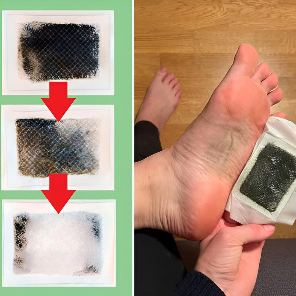 Detox Foot Patches (20 Pieces – Pack of 2)