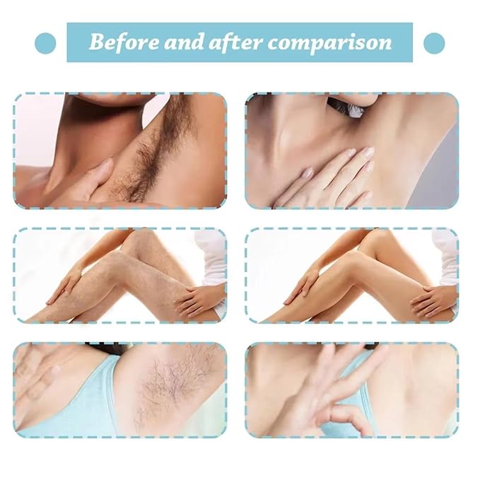 Never Grow Hair Serum – Smooth Skin Formula
