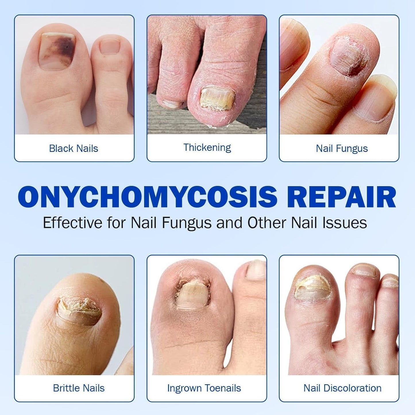 Fungal Nail Patch – Fast Toenail Repair Treatment