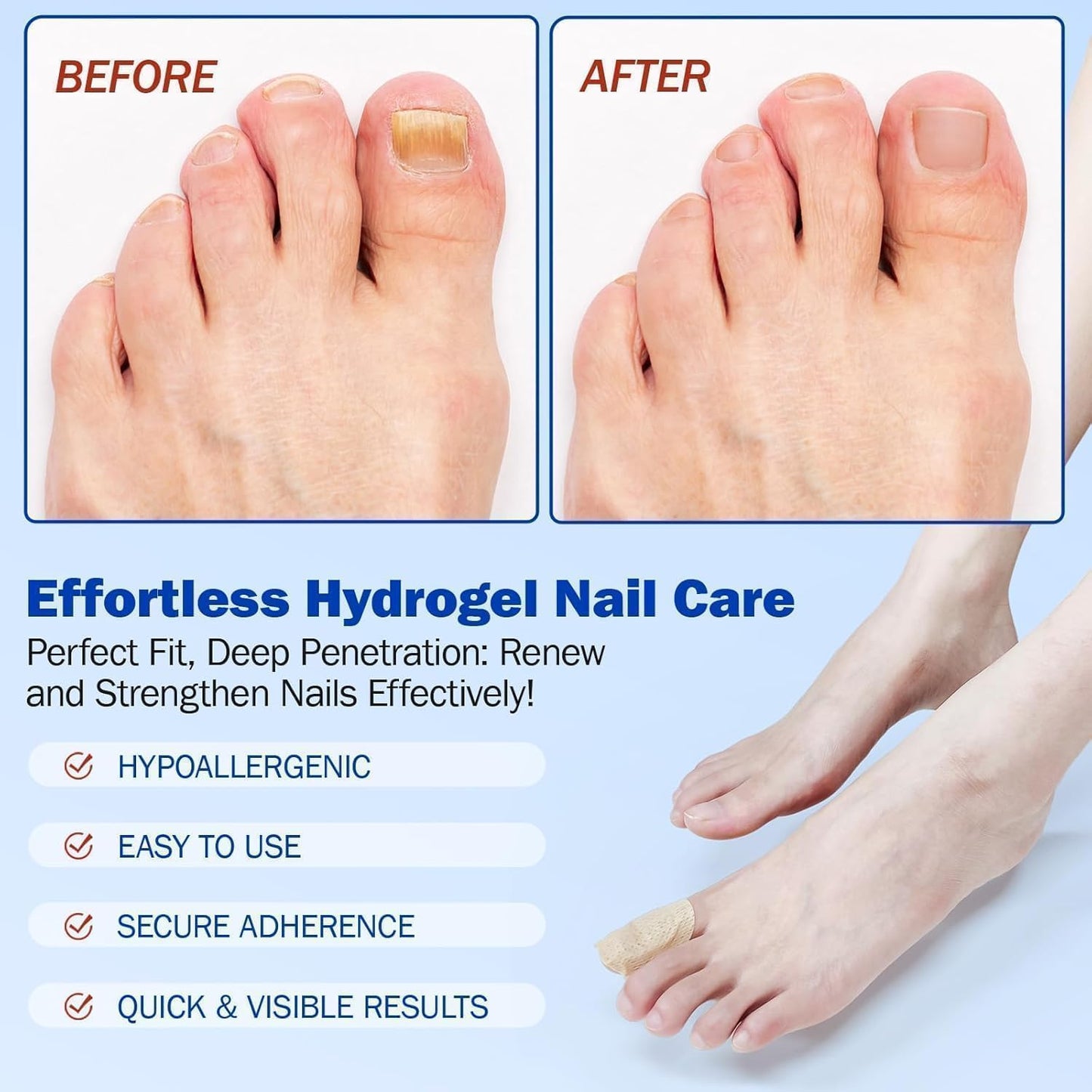 Fungal Nail Patch – Fast Toenail Repair Treatment
